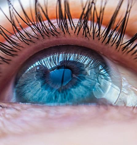 Close-up view of a scleral lens on an eye